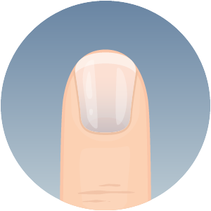 Fingernail showing nail discoloration changes